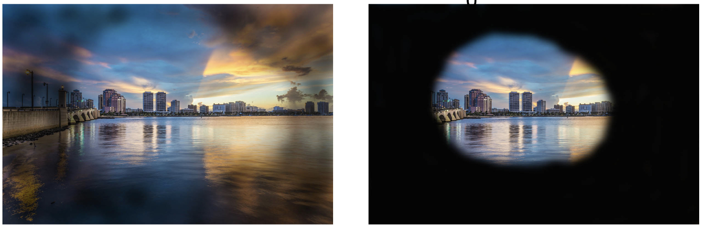 Die jongste inligting oor Gloukoom: Vroeë behandeling kan blindheid voorkom