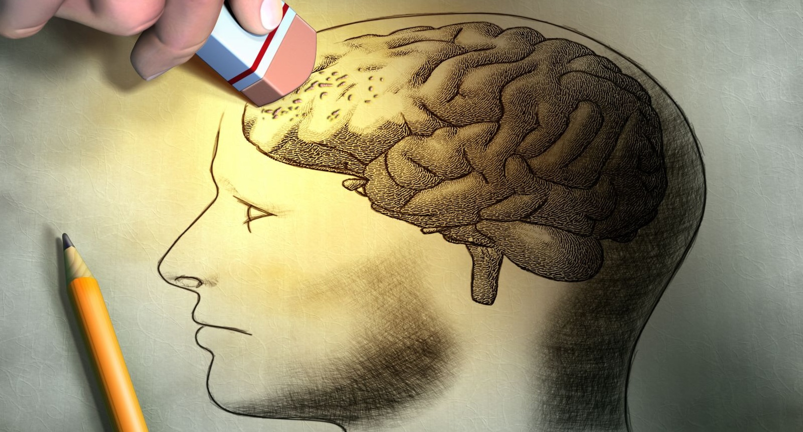 1e in SA: Operasie kan demensielyers help