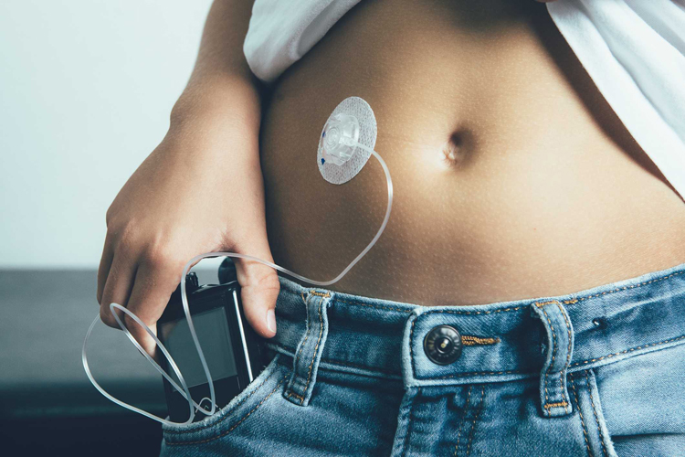 Tipe 1 Diabetes: Oorsake, simptome en behandeling